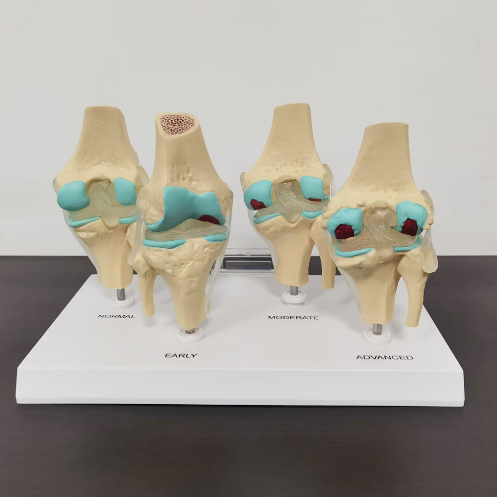 4-stufiges Kniegelenk modell K – Medical Lab Technology Bewertung und Preis