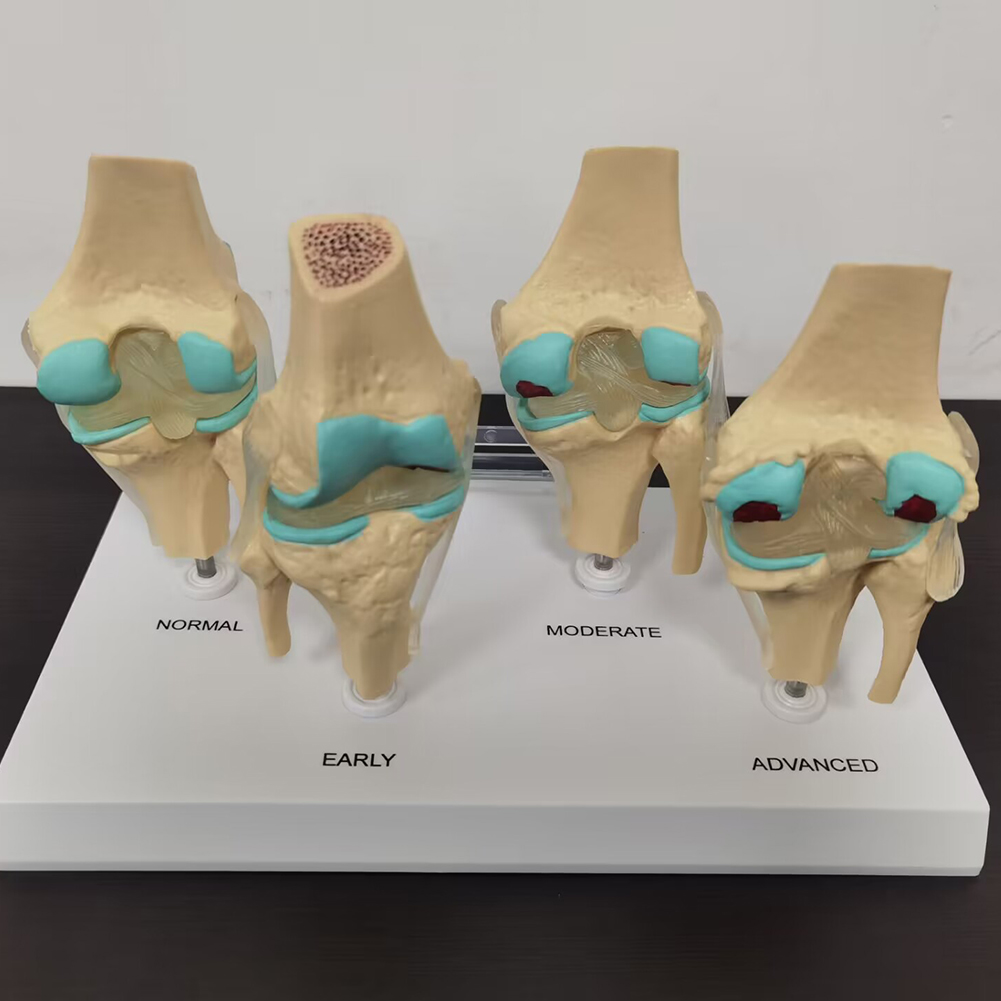 4-stufiges Kniegelenk modell K – Medical Lab Technology Bewertung und Preis