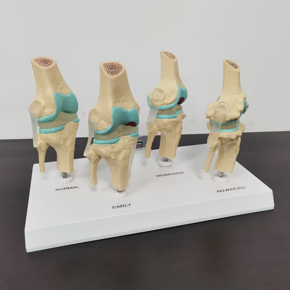4-stufiges Kniegelenk modell K – Medical Lab Technology Bewertung und Preis